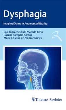dysphagia (ebook)-evaldo dacheux de macedo filho-rosane sampaio santos-maria cristina de alencar nunes-9786555722611