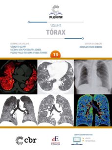 volume 13 - torax (ebook)-ronaldo hueb baroni-gilberto szarf-luciana volpon soares souza-9786561031011