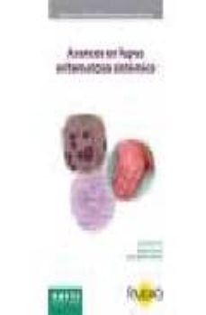 avances en lupus eritematoso sistemico-9788486684921
