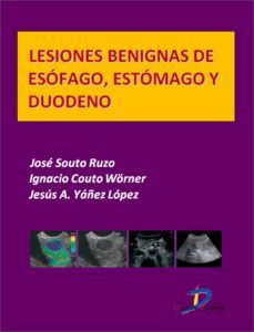 lesiones benignas de esofago, estomago y duodeno (ebook)-9788499697321