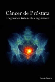 cancer de prostata (ebook)-pedro souza-3410009187331