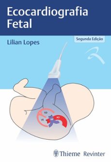 ecocardiografia fetal (ebook)-lilian lopes-9786555723731