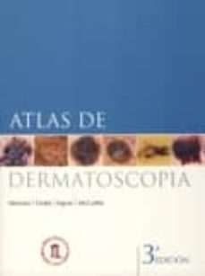 atlas de dermatoscopia-scott w. menzie-9788478855131