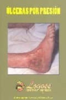 ulceras por presion-francisco cordon llera-9788495869531