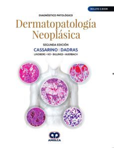diagnostico patologico. dermatopatologia neoplasica (incluye e-bo ok) (2ª ed.)-9789804300431