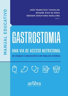 manual educativo: gastrostomia, uma via de acesso nutricional em crianças e adolescentes com paralisia cerebral (ebook)-joão francisco tussolini-rosane dias da rosa-gerson suguiyama nakajima-9786525064741