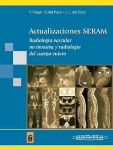 actualizaciones seram radiologia vascular no invasiva y radiologia del cuerpo entero-9788498351651