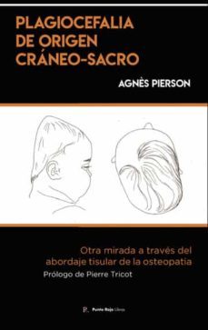 plagiocefalia de origen craneo-sacro-miguel hernandez callejo-9788419537461