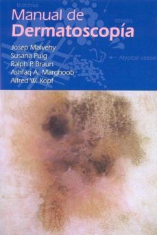 manual de dermatoscopia-j. malvehy-9788461111961