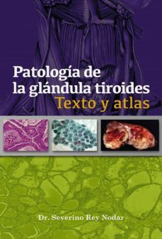 patologia de la glandula tiroides (ebook)-severino rey nodar-9788468614861
