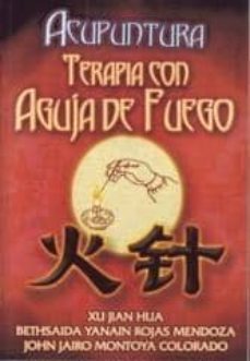 acupuntura. terapia con aguja de fuego-9789707830561