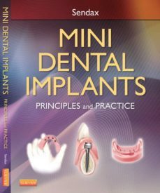 mini dental implants-victor sendax-9781455744671