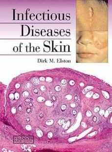 infectious diseases of the skin-dirk m. elston-9781840761771