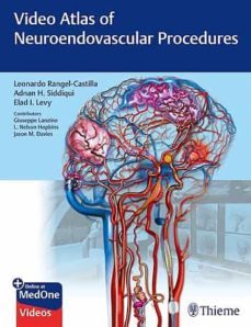 video atlas of neuroendovascular procedures-9781684201181