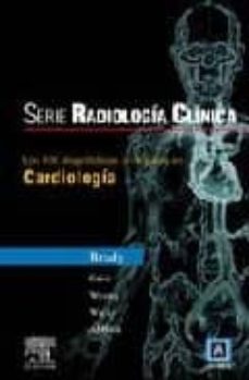 los 100 diagnosticos principales en cardiologia (serie radiologia clinica)-thomas j. brady-9788481749281