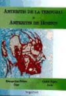 arteritis de la temporal o arteritis de horton-evangelina palero diaz-carlos tejero juste-9788493563981