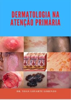 dermatologia na atenço primaria (ebook)-yoan loyarte lorenzo-3410004007191