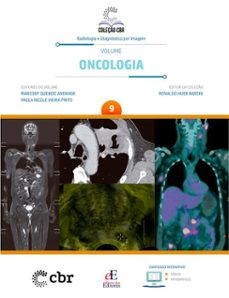 volume 9 - oncologia (ebook)-marcony queiroz andrade-paula nicole vieira pinto-ronaldo hueb baroni-9786561030991