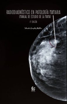 radiodiagnostico en patologia mamaria (4ª ed.)-yolanda gonzalez mullor-9788413013091