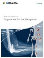 periprosthetic fracture management-michael schutz-carsten perka-9783131715111 periprosthetic fracture management-michael schutz-carsten perka-9783131715111