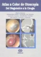 atlas a color de otoscopia: del diagnostico a la cirugia-mario sanna-9789806574151 atlas a color de otoscopia: del diagnostico a la cirugia-mario sanna-9789806574151