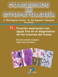 puncion aspiracion con aguja fina en el diagnostico de los tumore s de hueso-julio rodriguez costa-9788499694221 puncion aspiracion con aguja fina en el diagnostico de los tumore s de hueso-julio rodriguez costa-9788499694221