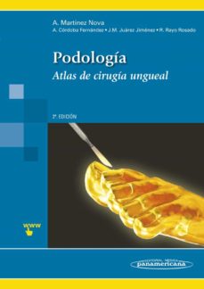 Descargas audibles de libros gratis PODOLOGÍA. ATLAS DE CIRUGÍA UNGUEAL 9788498357721 de ALFONSO MARTINEZ NOVA PDB en español