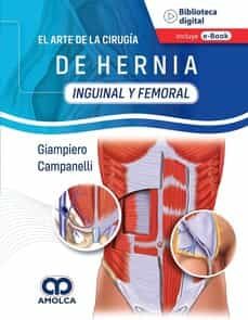 Libro de texto nova EL ARTE DE LA CIRUGÍA DE HERNIA. INGUINAL Y FEMORAL in Spanish 9789585348721