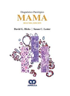Ebook descargas de libros de texto gratis DIAGNÓSTICO PATOLÓGICO: MAMA in Spanish de D. - LESTER, S. HICKS