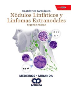 Descargar ebooks gratuitos en pdf para kindle DIAGNOSTICO PATOLOGICO. NÓDULOS LINFATICOS Y LINFOMAS EXTRANODALES + E-BOOK 9789804300851 de MEDEIROS MOBI