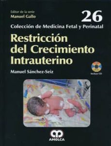 Descargar gratis libros electrónicos kindle amazon RESTRICCION DEL CRECIMIENTO INTRAUTERINO + DVD  in Spanish 9789588871561