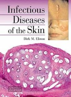 Libros para descargar para ipad INFECTIOUS DISEASES OF THE SKIN in Spanish MOBI 9781840761771 de DIRK M. ELSTON