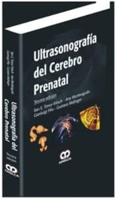 Descarga gratuita de ebooks ULTRASONOGRAFIA DEL CEREBRO PRENATAL (3ª ED.) de ILAN E. TIMOR-TRITSCH 9789588816081