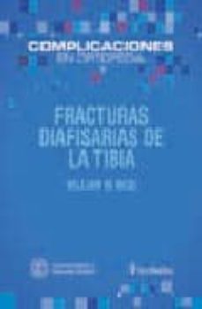 Descargador de libros mp3 gratis en línea FRACTURAS DIAFISARIAS DE LA TIBIA (COMPILACIONES EN ORTOPEDIA)